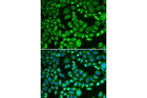 Immunofluorescence analysis of MCF-7 cells using PSMD7 antibody. (PSMD7 antibody)