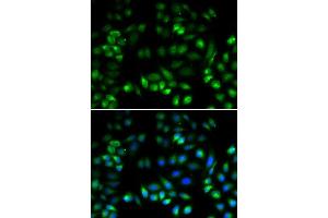 Immunofluorescence analysis of U2OS cells using MANF antibody. (MANF antibody  (AA 25-182))
