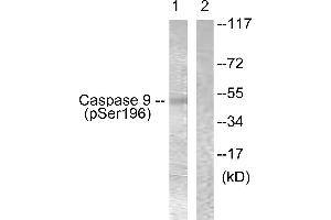 Western blot analysis of extracts from 293 cells, treated with Calyculin (50nM, 30mins), using Caspase 9 (Phospho-Ser196) antibody. (Caspase 9 antibody  (pSer196))