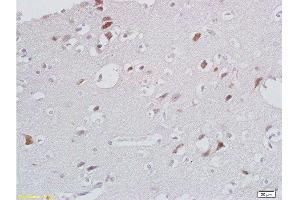 Formalin-fixed and paraffin embedded human brain labeled with Anti- CXCL13/BCA1 Polyclonal Antibody, Unconjugated  at 1:200 followed by conjugation to the secondary antibody and DAB (CXCL13 antibody  (AA 23-109))