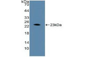 Detection of Recombinant ARNT, Human using Polyclonal Antibody to Aryl Hydrocarbon Receptor Nuclear Translocator (ARNT) (ARNT antibody  (AA 624-789))