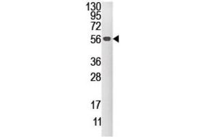 Western Blotting (WB) image for anti-Dual Specificity Phosphatase 4 (DUSP4) antibody (ABIN3003764) (DUSP4 antibody)