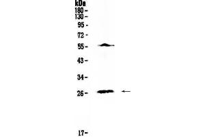 Western blot analysis of IL17 using anti-IL17 antibody . (Interleukin 17a antibody  (AA 26-158))