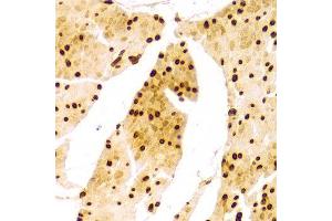 Immunohistochemistry (IHC) image for anti-Lamin A/C (LMNA) (AA 403-572) antibody (ABIN3020785)