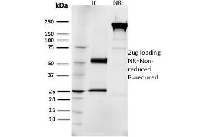 SDS-PAGE Analysis Purified EGFR Mouse Monoclonal Antibody (R1). (EGFR antibody  (AA 6-273))