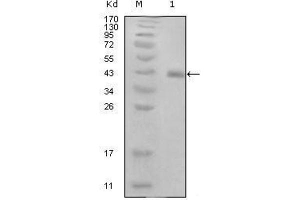 HPV16 E7 antibody