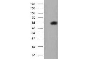 HEK293T cells were transfected with the pCMV6-ENTRY control (Left lane) or pCMV6-ENTRY SMAD2 (Right lane) cDNA for 48 hrs and lysed. (SMAD2 antibody)