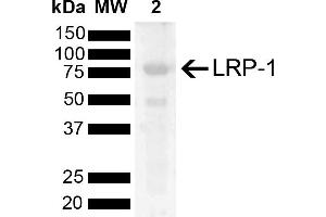 Western blot analysis of Rat Kidney showing detection of 504. (LRP1 antibody  (AA 2880-2980))