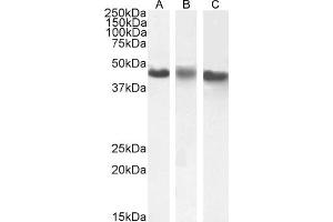 ABIN238540 (1 μg/mL) staining of A431(A), HeLa (B) and K562 (C) nuclear cell lysate (35 μg protein in RIPA buffer). (CK1 epsilon antibody  (C-Term))
