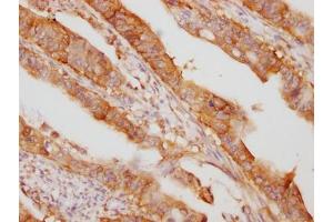 Immunohistochemistry (IHC) image for anti-Eukaryotic Translation Initiation Factor 5A (EIF5A) antibody (ABIN7127469)