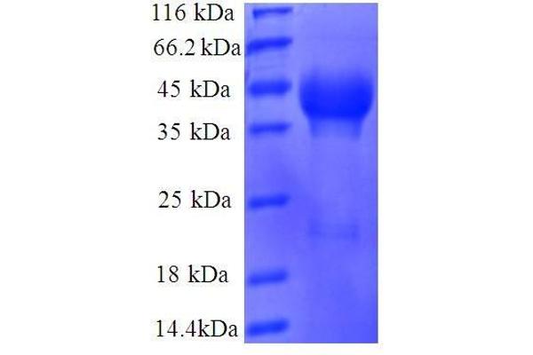 RPL35 Protein (AA 2-123, full length) (GST tag)