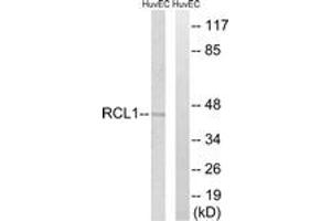 Western blot analysis of extracts from HuvEc cells, using RCL1 Antibody. (RCL1 antibody  (AA 324-373))