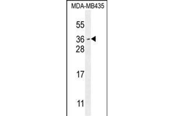 Myc Target 1 antibody  (C-Term)