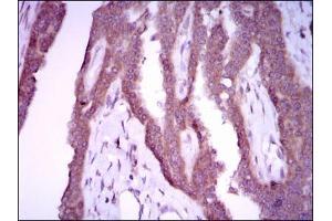 Immunohistochemistry (IHC) image for anti-Nitric Oxide Synthase 2, Inducible (NOS2) antibody (ABIN969551)