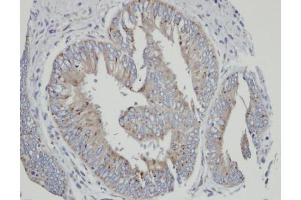 CYP4A11 antibody  (Center)