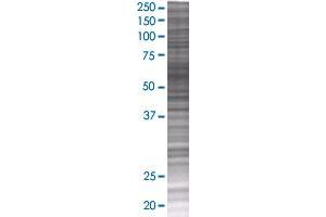 SMAD6 transfected lysate. (SMAD6 293T Cell Transient Overexpression Lysate(Denatured))