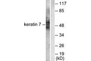 Western blot analysis of extracts from HepG2 cells, using Keratin 7 Antibody. (Cytokeratin 7 antibody  (AA 420-469))