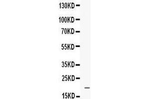 Western blot analysis of Prokineticin 1 expression in MCF-7 whole cell lysates (lane 1). (Prokineticin 1 antibody  (AA 20-105))