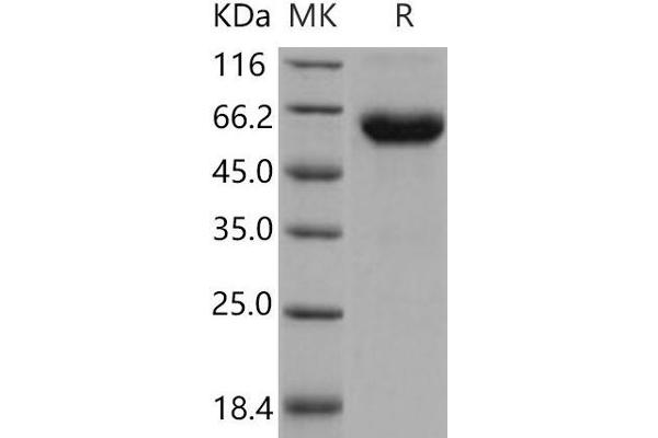 ACVR2B Protein (His tag,Fc Tag)