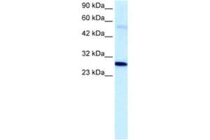 Western Blotting (WB) image for anti-Poly (ADP-Ribose) Polymerase 1 (PARP1) antibody (ABIN2460801) (PARP1 antibody)