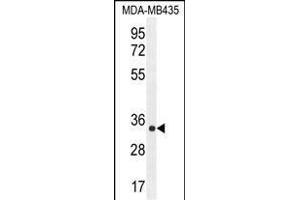 ALKBH6 antibody  (AA 116-145)