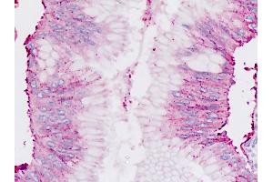 Human Pancreas: Formalin-Fixed, Paraffin-Embedded (FFPE) (Chordin antibody  (C-Term))