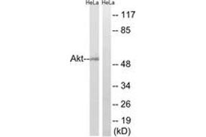 Western Blotting (WB) image for anti-AKT 1/2/3 (AA 431-480) antibody (ABIN2888942) (AKT 1/2/3 antibody  (AA 431-480))