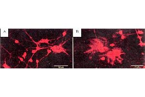 Image no. 1 for anti-BAPTA antibody (ABIN264974) (BAPTA antibody)