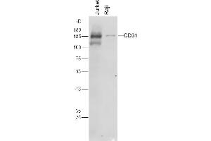 Lane 1: Jurkat cell lysates, Lane 2: Raji cell lysates, probed with CD31 (3B5) Polyclonal Antibody, unconjugated  at 1:300 overnight at 4°C followed by a conjugated secondary antibody for 60 minutes at 37°C. (CD31 antibody  (AA 28-601))