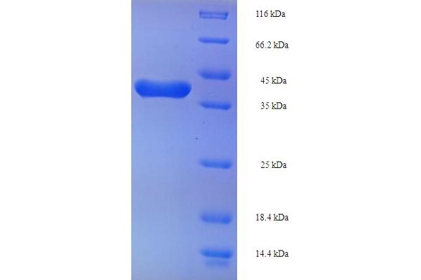 TAGLN2 Protein (AA 2-199) (His-SUMO Tag)