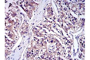 Immunohistochemistry (IHC) image for anti-Interleukin-1 Receptor-Associated Kinase 4 (IRAK4) antibody (ABIN969218)