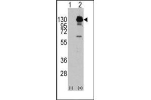 Image no. 1 for anti-Platelet Derived Growth Factor Receptor alpha (PDGFRA) (Tyr762) antibody (ABIN359910) (PDGFRA antibody  (Tyr762))