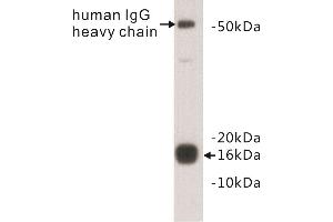 Western Blotting (WB) image for anti-Transthyretin (TTR) antibody (ABIN1854965) (TTR antibody)