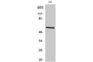 Western Blotting (WB) image for anti-Checkpoint Kinase 2 (CHEK2) (Tyr594), (Tyr604) antibody (ABIN3183905) (CHEK2 antibody  (Tyr594, Tyr604))