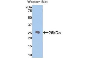 Detection of Recombinant Bcl2, Rat using Polyclonal Antibody to B-Cell Leukemia/Lymphoma 2 (Bcl2) (Bcl-2 antibody  (AA 2-208))