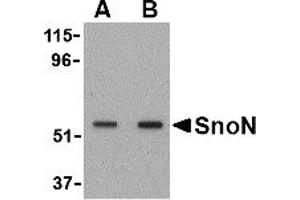 Western Blotting (WB) image for anti-SKI-Like Oncogene (SKIL) (N-Term) antibody (ABIN1031579) (SKIL antibody  (N-Term))