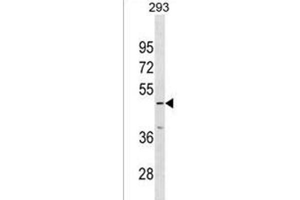 IP6K3 antibody  (N-Term)