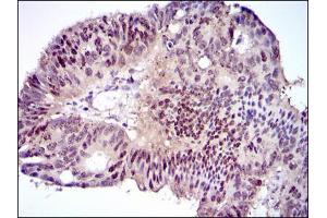 Immunohistochemistry (IHC) image for anti-CCAAT/enhancer Binding Protein (C/EBP), alpha (CEBPA) antibody (ABIN969048)