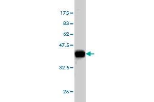 Western Blot detection against Immunogen (37. (CELSR3 antibody  (AA 71-180))