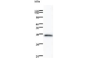 Western Blotting (WB) image for anti-Zinc finger protein ubi-d4 (DPF2) antibody (ABIN932486) (DPF2 antibody)