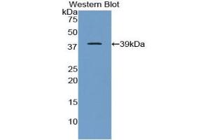 Western blot analysis of the recombinant protein. (APOC1 antibody  (AA 34-88))