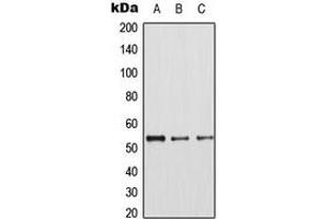 Western blot analysis of CDK8 expression in HepG2 (A), A549 (B), Raw264. (CDK8 antibody  (N-Term))