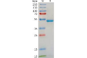 Human IL18 Protein, hFc Tag on SDS-PAGE under reducing condition. (IL-18 Protein (AA 37-197) (Fc Tag))