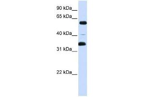 Western Blot showing ZKSCAN1 antibody used at a concentration of 1-2 ug/ml to detect its target protein. (ZKSCAN1 antibody  (Middle Region))