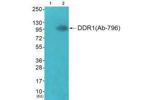 Western blot analysis of extracts from JK cells (Lane 2), using DDR1 (Ab-796) antiobdy. (DDR1 抗体  (Tyr796))