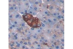 IHC-P analysis of Human Tissue, with DAB staining. (LGALS9C antibody  (AA 228-356))