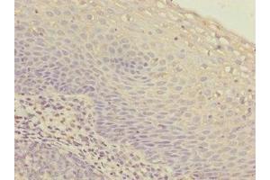 Immunohistochemistry of paraffin-embedded human tonsil tissue using ABIN7156265 at dilution of 1:100 (IKbIP antibody  (AA 121-350))