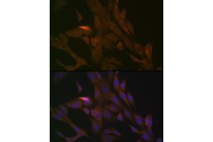Immunofluorescence analysis of NIH-3T3 cells using PER3 Rabbit mAb (ABIN7269225) at dilution of 1:100 (40x lens). (PER3 antibody)