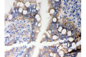 Anti- HLA-A Picoband antibody,IHC(P) IHC(P): Rat Intestine Tissue (HLA-A antibody  (N-Term))
