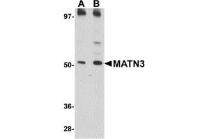 Western Blotting (WB) image for anti-Matrilin 3 (MATN3) (C-Term) antibody (ABIN1030509) (Matrilin 3 antibody  (C-Term))